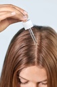 Scalp Treatment